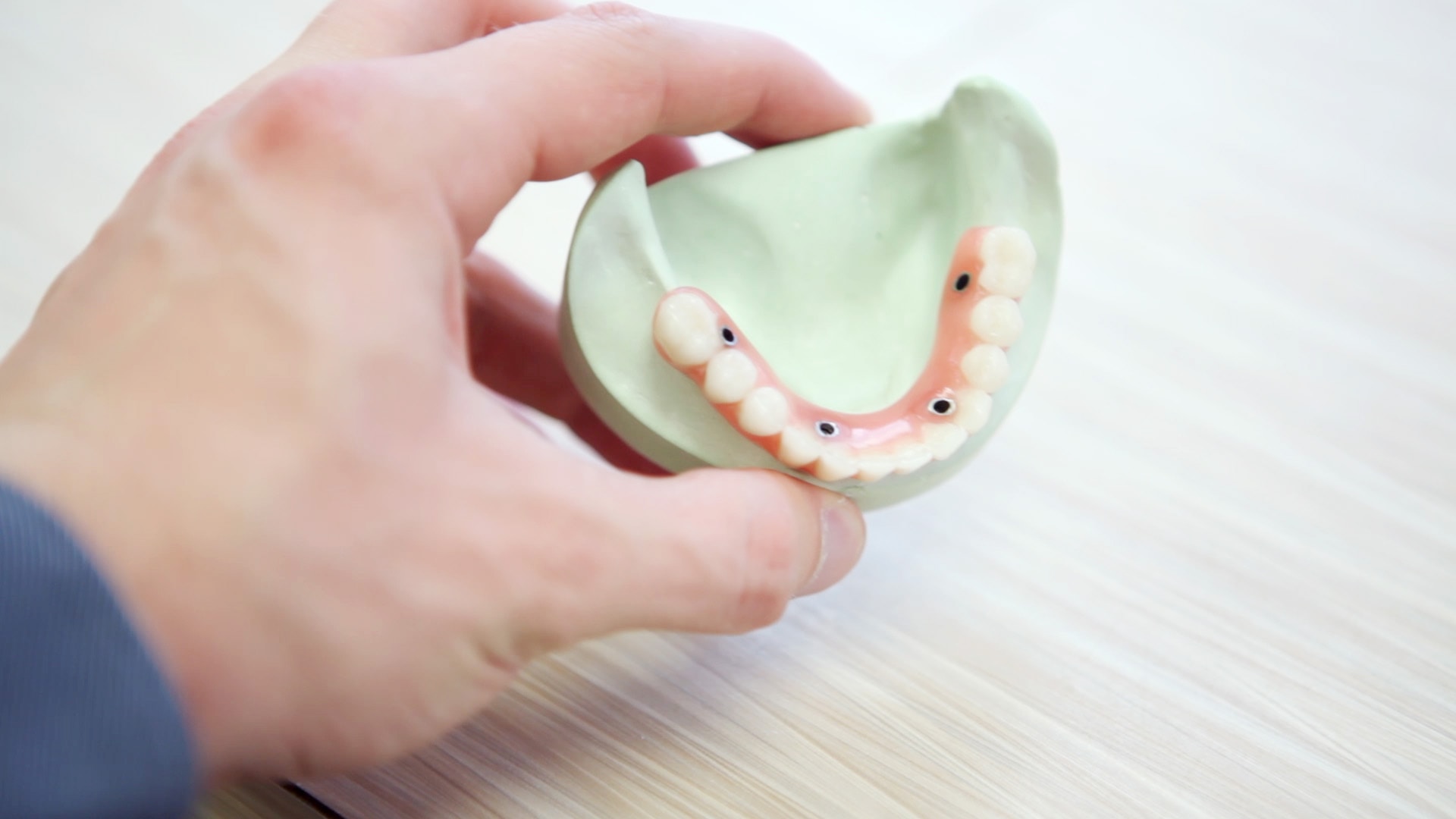 Jak wstawia się korony zębowe na implantach? Czy to możliwe?