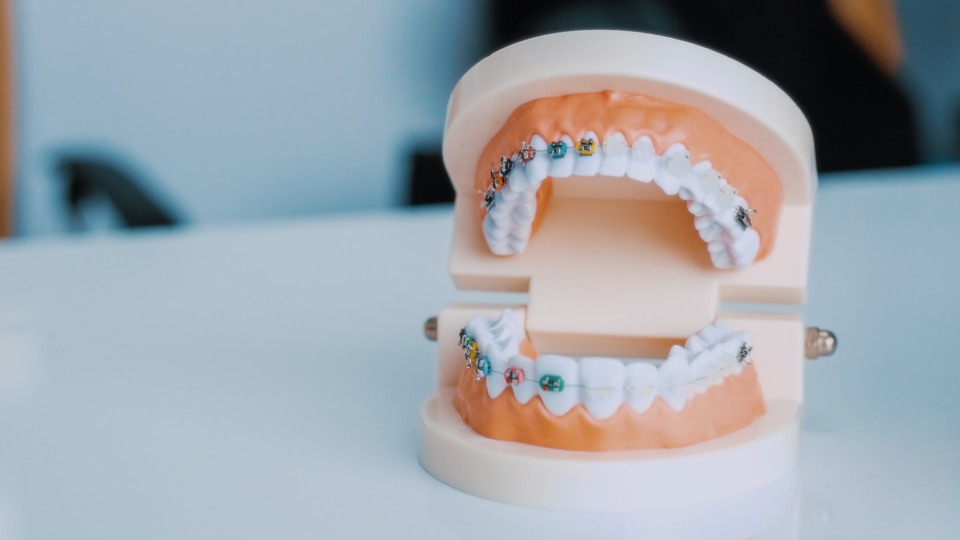 Czym jest ortodoncja i kiedy warto z niej skorzystać?